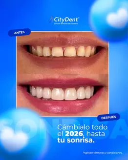 Catálogo Citydent | Cámbialo todo el 2026, hasta tu sonrisa | 2026-04-07T00:00:00.000Z - 2026-12-31T00:00:00.000Z